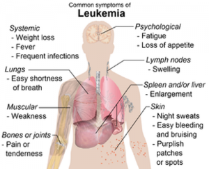 Leukemia Cancer Signs