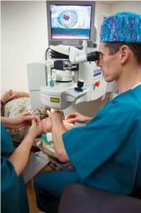 laser eye surgery