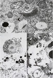 Lysosome Facts